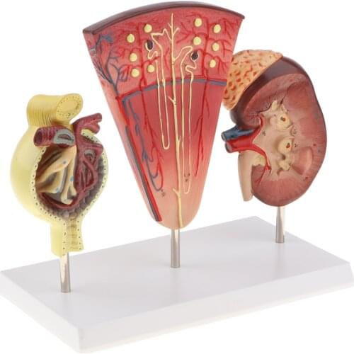 Anatomical Kidney Model Section, with Nephron Glomerulus, with Stand Base, for School Teaching Display, Lab Demonstration
