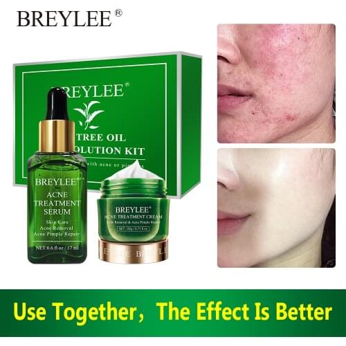 BREYLEE Anti Acne Face Serum Cream Treatment Facial Pimple Spots Remover Oil Control Shrink Pores Moisturizing Repair Skin Care