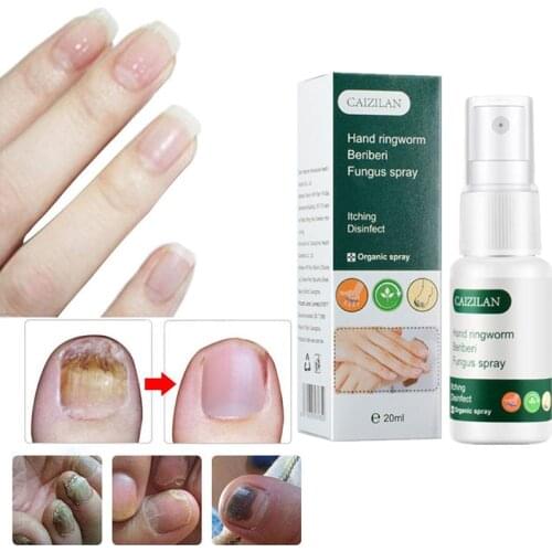 20ml Foot Anti Fungus Essence Serum Remove Onychomycosis Repair Treatment Liquid Health Nail Care Repair Liquid Solution