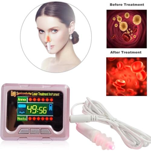 650nm Laser De Diodo Wrist Watch High Blood Pressure Diabetes Cholesterol Rhinitis Sinusitis Treatment Diabetic Physiotherapy