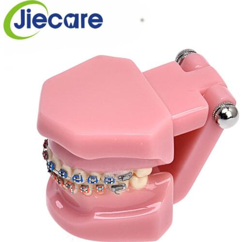 1 PC Dental Pink Orthodontic Mallocclusion Teeth Model With Brackets Archwire Buccal Tube Tooth Extraction For Teaching