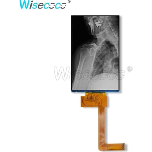 Wisecoco High Resolution 6 Inch 2k 1620x2560 Monochrome 3D Printer LCD Display Screen For Industry Medical Treatment