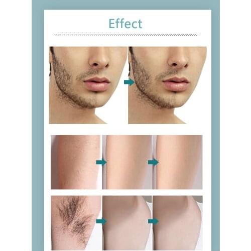 Powerful Permanent Painless Hair Removal Spray Stop Hair Growth Inhibitor Shrink Pores Skin Smooth Repair Essence