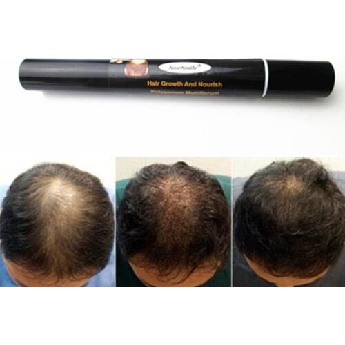 SowSmile Hair Growth Masks