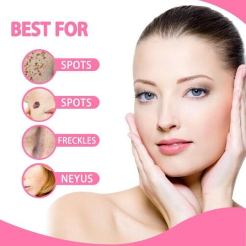 Skin Tag Remover 20ML Organic Tags Solutions Serum Exfoliante Serum Beauty MoisturizerTSLM1