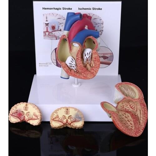Life Size Disassembled Anatomical Human Heart Anatomy Model for School Science Resources Study Display Teaching Tool