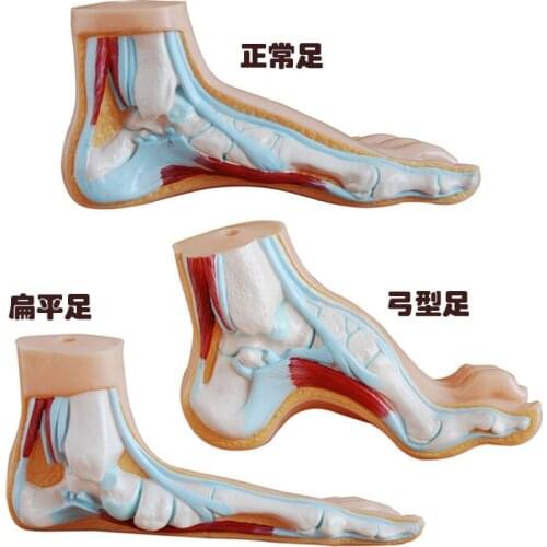 1:1life Sized Human Normal Flat Arched Foot Model Foot Arch Model Anatomy Teaching Model