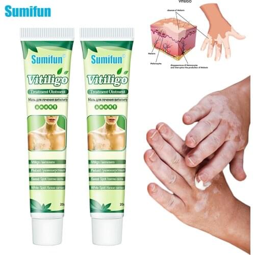 Sumifun 1pc 20g Vitiligo Ointment Mycosis Leukoplakia Psoriasis Localized Plaster White Spot Cream Promote Skin Pigment Melanin