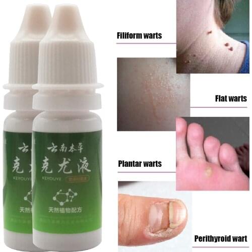 Wart Remover Rapidly Against Mole Warts Drop Papillomas Treatment Skin Tag Ointment Chinese Medicine Spray Personal Body Care