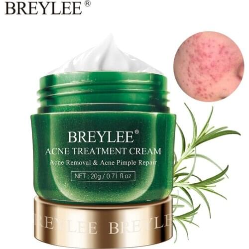 BREYLEE Effective Acne Removal Cream Treatment Fade Acne Spots Scar Oil Control Shrink Pores Whiten Moisturizing Gel Skin Care