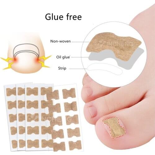 Ingrown Toenail Corrector Sticker Paronychia Treatment Fixer Recover Corrector Pedicure Foot Toe Nail Care Tool Glue Free care