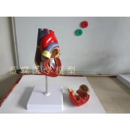 1:1 medical heart teaching of human heart anatomy model B hyperchromatic heart model