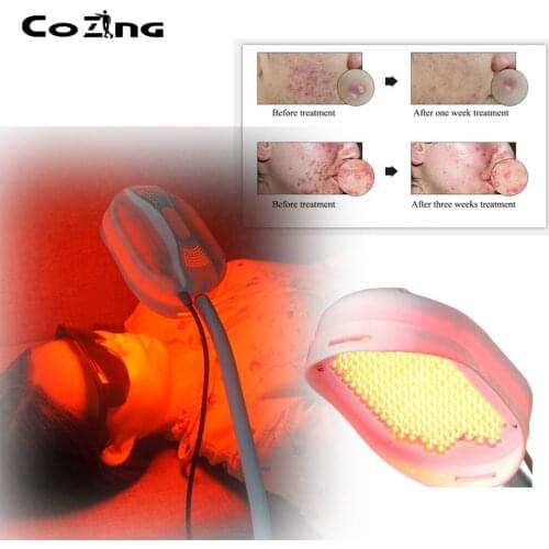 Beauty products multi-Function Photodynamic Phototherapy 210 LED medical grade for Skincare and Acne removal