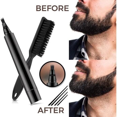 Macroupta Hair Loss Remedies