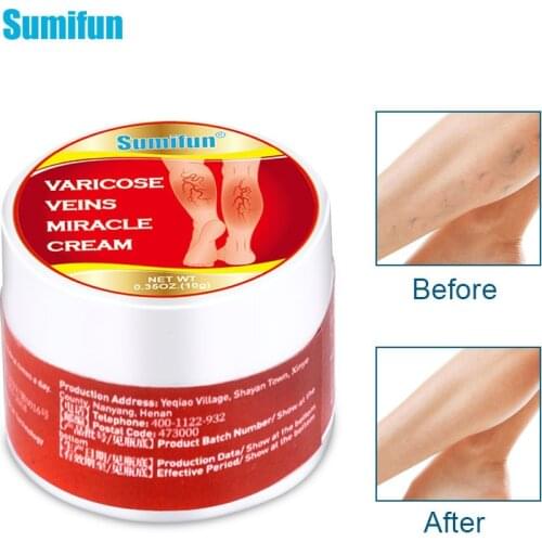 Varicose Veins Treatment Cream Vasculitis Phlebitis Spider Ointment Varicosity Angiitis Removal Herbal Medical Plaster 10g