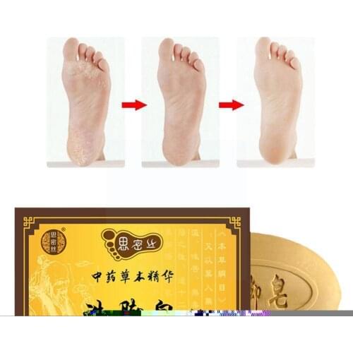 90g China Medicated Foot Soap Itchy Feet Foot Bath Itching Rotten Fungus Sweat Peeling Feet Soap Bath Handmade Soap Anti Fo K1O0