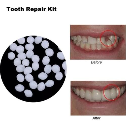 Denture Solid Glue Dental material Temporary Tooth Repair Kit Oral hygiene Care Tool teeth whitening instrument braces dentist