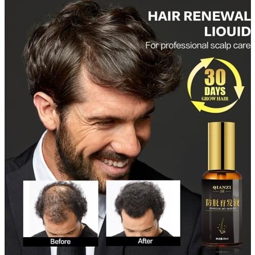 Anti Hair Loss Treatment Hair Growth Essence Oil for Fast Hair Growth Hair Care Product Nourishing Hair Root Solution Hair Tonic