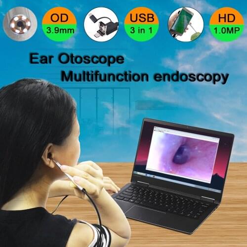 Ear Cleaners OMCAM China