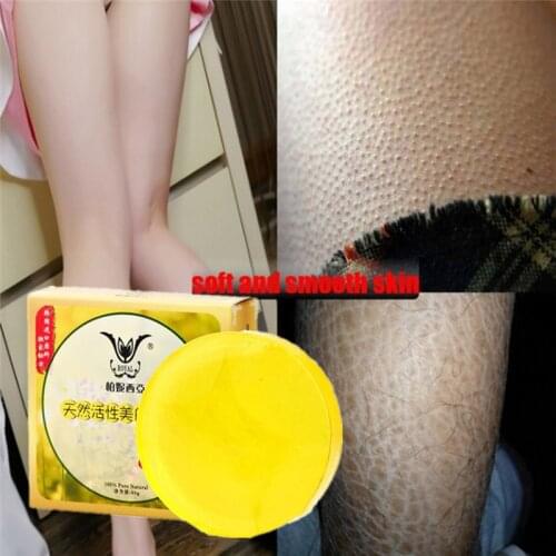 Curing Keratosis Pilaris/ Chicken Skin Body Lotion Skin Repair Hair Follicles Soap Skin Care Essence For Face Whole Body Soap