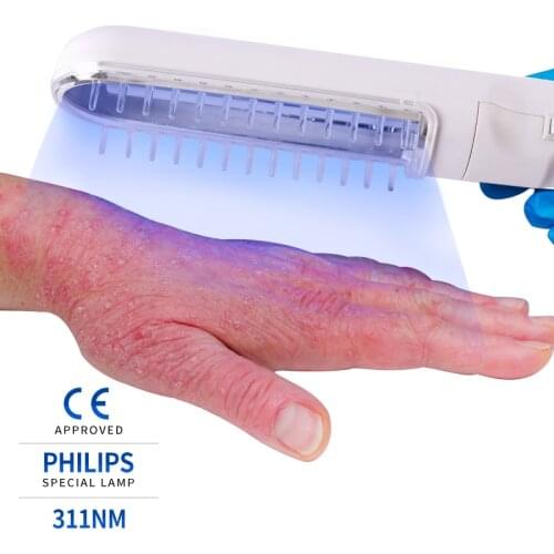 UVB Lamp Psoriasis Home Phototherapy Devices Handheld For Vitiligo Eczema 311NM Narrowband Ultraviolet 110V 220V 50Hz 60Hz