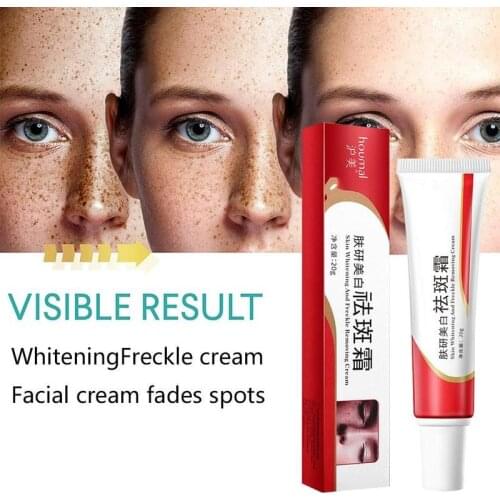20ml Whitening Fades Spots Cream Repair Face Freckle Acne Scar Creams Shrink Pores Oil Control Moisturizer Skin Care