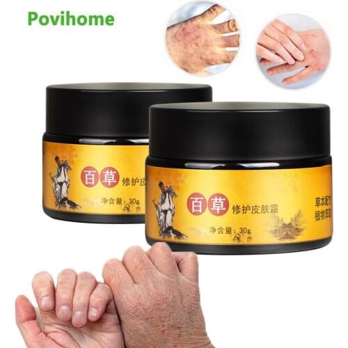 1Pcs 30g Skin Repair Cream Herbal Anti-Crack Care Moisturizing Ointment Dermatitis Eczema Psoriasis Treatment Medical Plaster