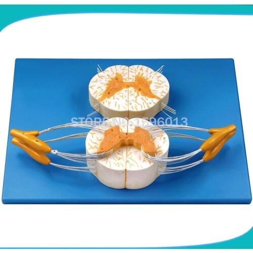 HOT Spinal Cord with Nerve Branches Model ,spinal cord and spinal nerve branch model
