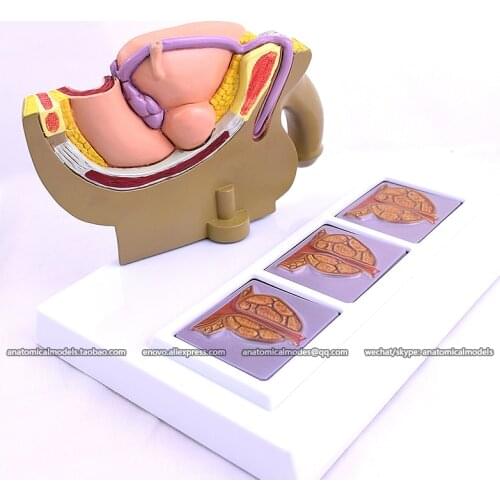 12044/ Pathological Model of Male Urogenital System