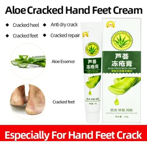 Aloe Antifreeze Antibacterial Cream Treatment Frostbite Cause Hand Foot Dry Crack Heel Chapped Peeling Skin Care Ointment20g