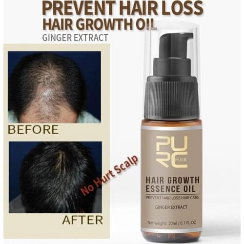 Hot sale Fast Hair Growth Essencial Oil Hair Loss Treatment Help Care For hair Hair 20ml Growth B8C8