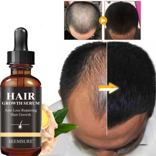 AMAZING!!! Effective Natural Ginseng Plant Serum Hair Loss Treatment Repair Hair Loss Product Series Hair Growth Products