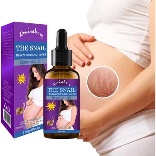 Gecomo Stretch Mark Oils China