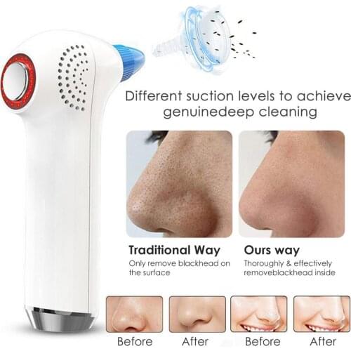 USB Recharge Electric Blackhead Remover Safe Blackhead Pore Cleaner Device Hot And Cold Compress Facial Cleansing Skin Care Tool