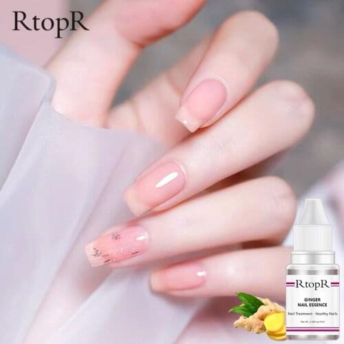 Fungal Nail Treatment Feet Care Essence Nail Foot Whitening Toe Nail Fungus Removal Gel Anti Infection Paronychia Onychomycosis