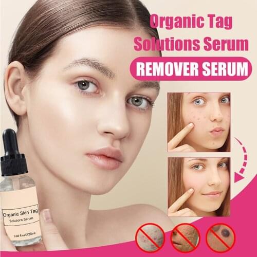 High Quality Seamless Moles Remover Moles Remove Skin Black Moles