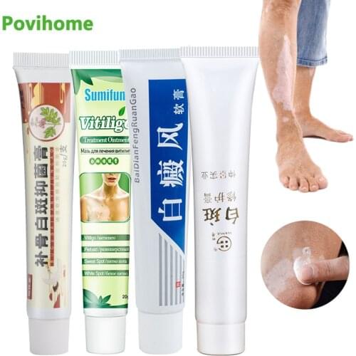 4Types Vitiligo Treament Cream White Spot Antibacterial Ointment Leukoplakia Skin Melanin Deposition Health Care Medical Plaster