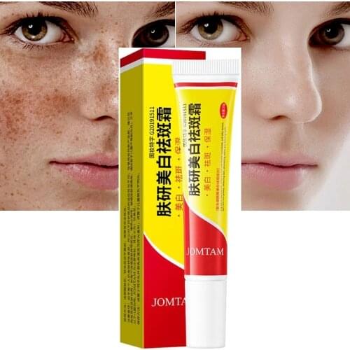 Effective Whitening Freckle Cream Remove Melasma Acne Spot Pigment Melanin Dark Spots Pigmentation Moisturizing Whitening Cream