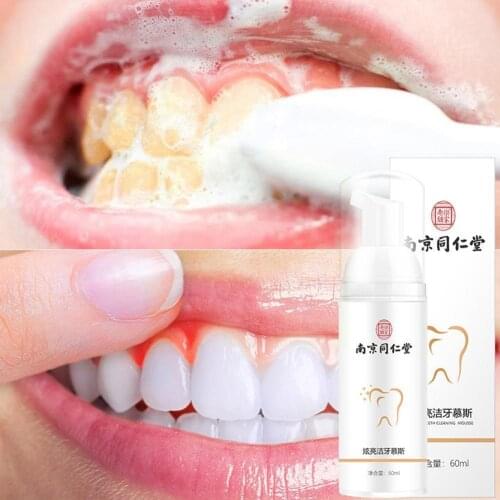 Teeth Cleansing Whitening Mousse Removes Stains Teeth Mousse Toothpaste Stain Hygiene Whitening And Whitening Oral U2Y4