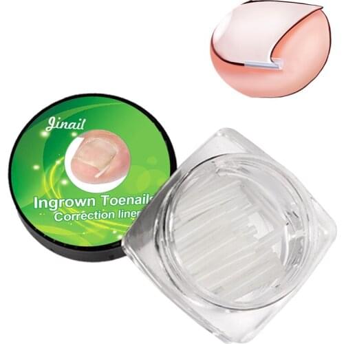 10PCS/Set Professional Embedded Toe Nail Corrector Pads Ingrown Nail Corrector Nail Artifacts Orthopedic Foot Care Tool