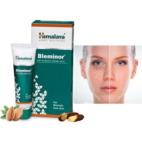 Himalaya Bleminor Anti blemish Cream 30ml Hyperpigmentation Acne Remove Skin Whitening Care