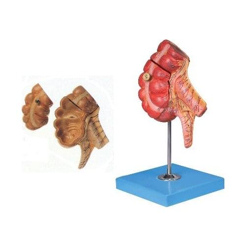 Cecum and appendix model Cecum model appendix model intestine model
