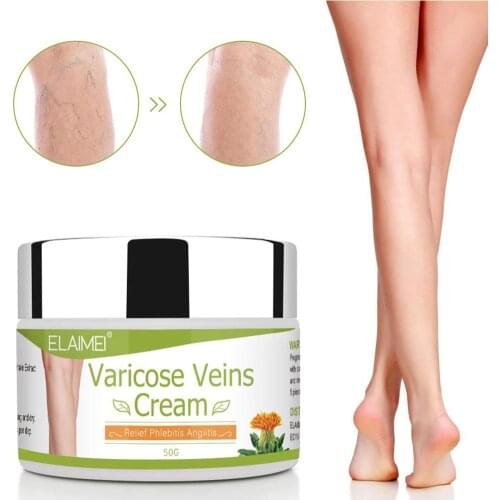 1Pcs 170g Varicose Veins Ointmnet Vasculitis Phlebitis Spider Cream Varicosity Angiitis Removal Herbal Medical Plaster