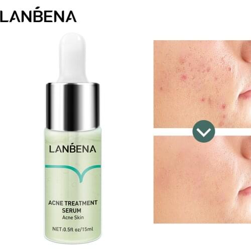 LANBENA 15ml Acne Remove Serum Improve Skin Roughness Shrinking Pore Whitening Moisturizing Repair Acne Smooths Skin for Face