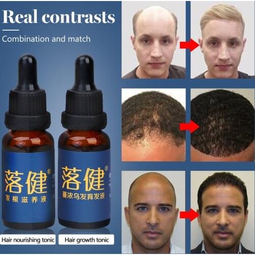 Hair Growth Essence Anti Hair Loss Fast Growth of Hair Thick Hair Repair Hair Root and Scalp Hair Care Nutrient Solution