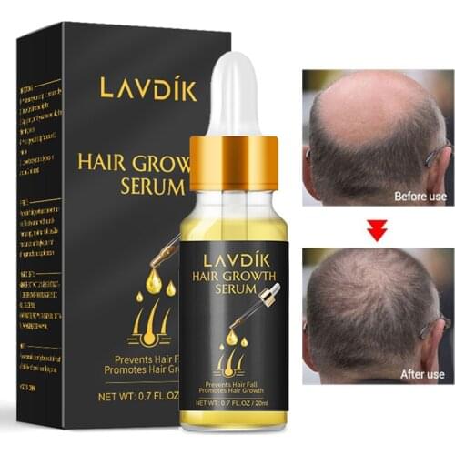 20ml Treatment Hair Growth Essential Oils Anti-loss Fast Hair Regrowth Liquid Serum Nourishing Repairing Care Damaged Hair Oil