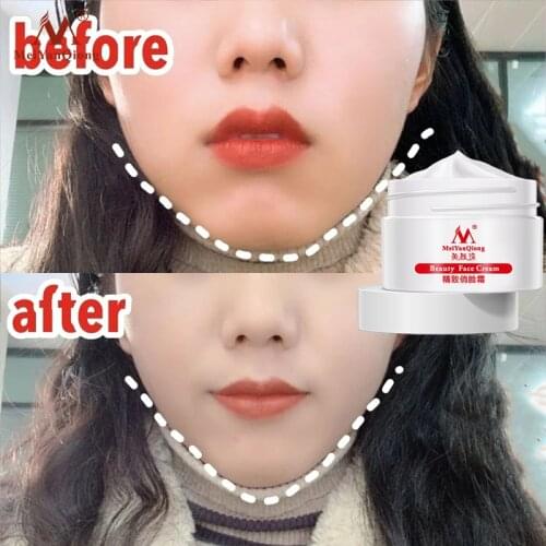 MeiYanQiong Hyaluronic Acid Slimming Firming Massage Cream Anti-aging Whitening Moisturizing Beauty Skin Care Facial Cream 40g