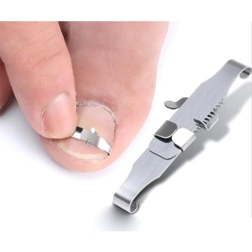 Ingrown Toe Nail Correction Tool Toenail Straightening Correctors Patch Tool Straightening Clip Brace Pedicure Tool