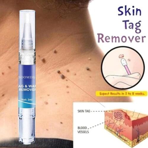 3ml Skin Tag Remover Pen Natural Health Mole Nevus Wart Skin Tag Foot Corn Warts Treatment Skin Tag Removal