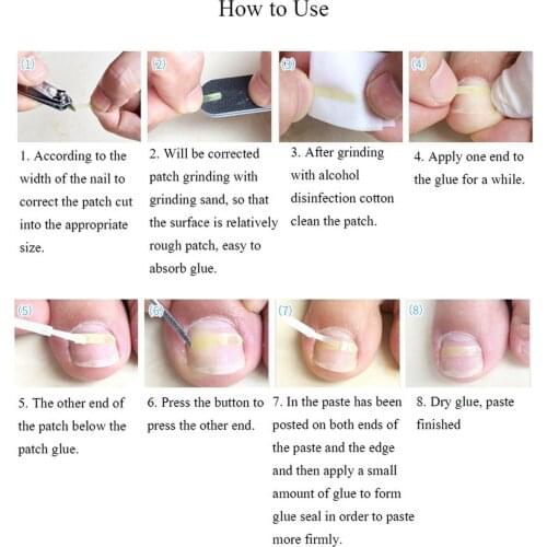 Ingrown Toenail Pedicure Tool Straightening Clip Curved Brace for Toenails Care